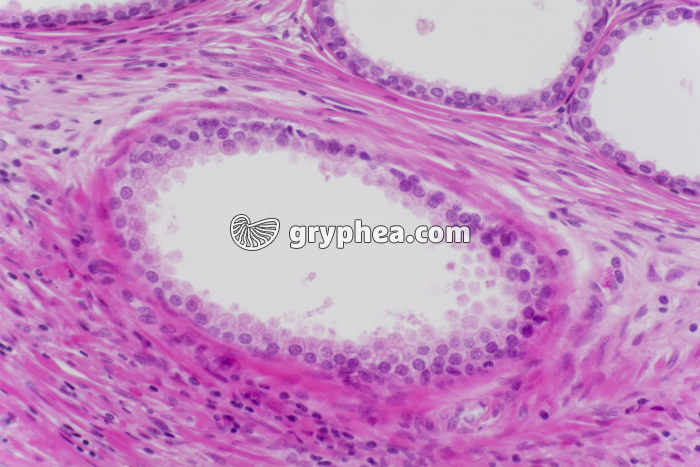 Prostate x100 - gryphea.com